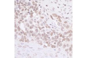 Immunohistochemistry (IHC) image for anti-MIS12, MIND Kinetochore Complex Component, Homolog (MIS12) (C-Term) antibody (ABIN7453483) (MIS12 anticorps  (C-Term))