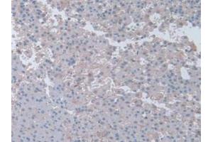 IHC-P analysis of Rat Adrenal Gland Tissue, with DAB staining. (Interferon gamma anticorps  (AA 23-156))