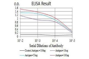 Black line: Control Antigen (100 ng),Purple line: Antigen (10 ng), Blue line: Antigen (50 ng), Red line:Antigen (100 ng)