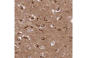 Immunohistochemical staining of human hippocampus with GOLGA3 polyclonal antibody  shows strong cytoplasmic positivity in neuronal cells at 1:500-1:1000 dilution. (Golgin A3 anticorps)