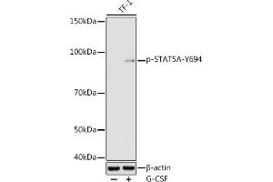 Western blot analysis of extracts of TF-1 cells, using Phospho-STA-Y694 antibody (ABIN3019613, ABIN3019614, ABIN3019615 and ABIN6225491) at 1:1000 dilution.