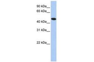 Image no. 1 for anti-Thioredoxin Domain Containing 5 (Endoplasmic Reticulum) (TXNDC5) (AA 36-85) antibody (ABIN6741464) (TXNDC5 anticorps  (AA 36-85))