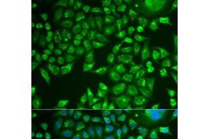 Immunofluorescence analysis of U2OS cells using PNLIP Polyclonal Antibody