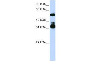 FBXW2 antibody used at 1 ug/ml to detect target protein. (FBXW2 anticorps  (Middle Region))