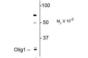 Image no. 1 for anti-Oligodendrocyte Transcription Factor 1 (OLIG1) antibody (ABIN372692) (OLIG1 anticorps)