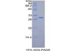 SDS-PAGE analysis of Rat FDFT1 Protein. (FDFT1 Protéine)
