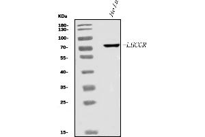 Western blot analysis of hCG receptor/LHR/LHCGR using anti-hCG receptor/LHR/LHCGR antibody (ABIN7602264).