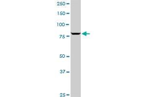 SP1 monoclonal antibody (M05), clone 4B11.