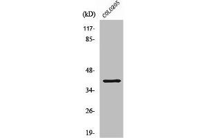 Western Blot analysis of COLO205 cells using ABHD6 Polyclonal Antibody (ABHD6 anticorps  (Internal Region))