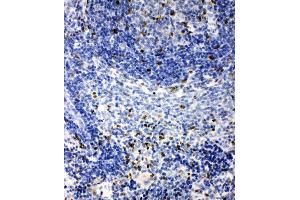 Anti-IRAK2 antibody, IHC(P) IHC(P): Rat Spleen Tissue
