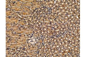 ABIN7095999 and ABIN7100061 at 1/100 staining mouse kidney tissue by IHC-P. (SOSTDC1 anticorps)