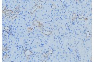 ABIN6279543 at 1/100 staining Mouse kidney tissue by IHC-P. (TAM41 anticorps  (Internal Region))