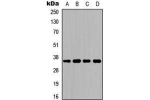 Western blot analysis of CD234 expression in HeLa (A), K562 (B), Raw264.