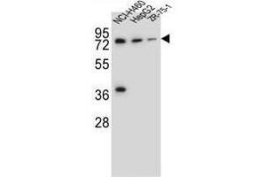 UGT2B15 Antibody (Center) western blot analysis in NCI-H460,HepG2,ZR-75-1 cell line lysates (35 µg/lane).