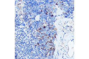 Immunohistochemistry of paraffin-embedded mouse spleen using IFNGR1 Rabbit pAb (ABIN6127566, ABIN6142197, ABIN6142198 and ABIN6221420) at dilution of 1:100 (40x lens). (IFNGR1 anticorps  (AA 270-489))