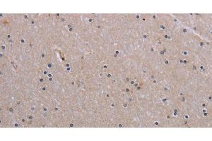 Immunohistochemistry of paraffin-embedded Human brain tissue using NAIP Polyclonal Antibody at dilution 1:30 (NAIP anticorps)