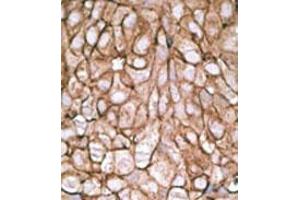 Image no. 2 for anti-Pyruvate Dehydrogenase Complex, Component X (PDHX) (C-Term) antibody (ABIN357414) (PDHX anticorps  (C-Term))
