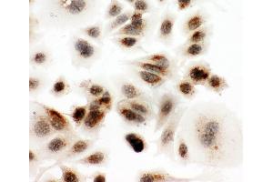 Anti-DDX4/MVH antibody, ICC ICC: MCF-7 Cell