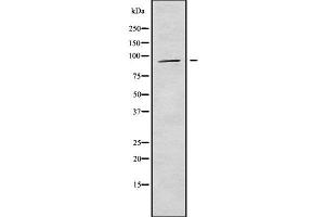 Western blot analysis of APBA1 using HeLa whole cell lysates