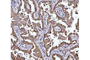IHC analysis of MRPS22 using anti-MRPS22 antibody (ABIN7600613). (MRPS22 anticorps  (AA 21-329))