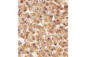 (ABIN6243304 and ABIN6577970) staining STMN2 in Human liver tissue sections by Immunohistochemistry (IHC-P - paraformaldehyde-fixed, paraffin-embedded sections).