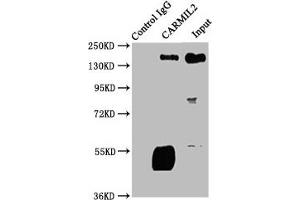 Immunoprecipitating CARMIL2 in Jurkat whole cell lysate Lane 1: Rabbit control IgG instead of ABIN7146660 in Jurkat whole cell lysate. (RLTPR anticorps  (AA 1136-1290))