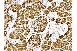 Immunohistochemical analysis of paraffin-embedded Human kidney section using Pink1 (ABIN6243087 and ABIN6577253).