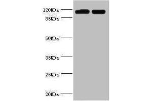 Western blot All lanes: PITRM1 antibody at 2 μg/mL Lane 1: A549 whole cell lysate Lane 2: Mouse kidney tissue Secondary Goat polyclonal to rabbit IgG at 1/10000 dilution Predicted band size: 118, 107 kDa Observed band size: 118 kDa (PITRM1 anticorps  (AA 758-1037))