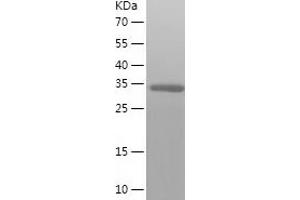 Western Blotting (WB) image for SERTA Domain Containing 2 (SERTAD2) (AA 1-314) protein (His-IF2DI Tag) (ABIN7125059)