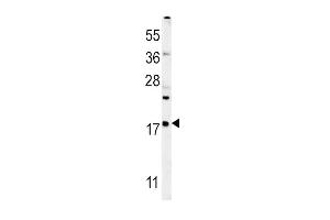 VP4 Antibody (Center) (ABIN652042 and ABIN2840516) western blot analysis in mouse liver tissue lysates (35 μg/lane).