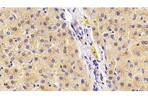 Detection of FGF21 in Porcine Liver Tissue using Polyclonal Antibody to Fibroblast Growth Factor 21 (FGF21) (FGF21 anticorps  (AA 28-208))