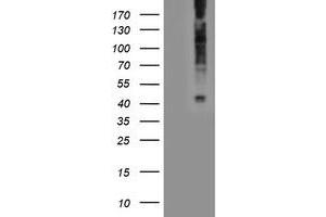 Western Blotting (WB) image for anti-Lysophosphatidic Acid Receptor 1 (LPAR1) antibody (ABIN1499191) (LPAR1 anticorps)