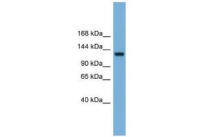 WB Suggested Anti-RASGRF1 Antibody Titration: 0. (RASGRF1 anticorps  (Middle Region))