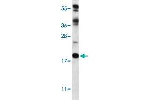 Western blot analysis of mouse heart tissue lysate (35 ug/lane) with RCAN2 polyclonal antibody . (RCAN2 anticorps  (N-Term))