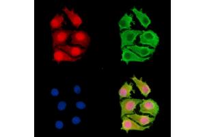 anti-Zinc Finger, RAN-Binding Domain Containing 1 (ZRANB1) antibody
