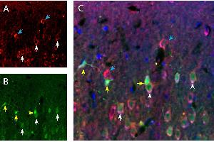 Free-floating frozen brain sections from a paraformaldehyde-perfused rat were incubated with Anti-Piezo1 (extracellular)-ATTO  Antibody (ABIN7885229, 1:100, orange), and anti-calbindin D28k antibody (Sigma #C9848, 1:300) followed by goat anti-rabbit secondary antibody conjugated to Alexa Fluor® 488 (green).