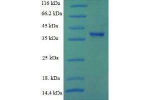 SDS-PAGE (SDS) image for Cyclin D1 (CCND1) (AA 1-295), (full length) protein (His tag) (ABIN5709223)