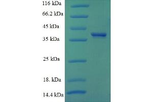 SDS-PAGE (SDS) image for Cyclin D1 (CCND1) (AA 1-295), (full length) protein (His tag) (ABIN5709223) (Cyclin D1 Protein (CCND1) (AA 1-295, full length) (His tag))
