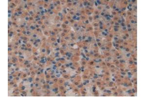 IHC-P analysis of Rat Stomach Tissue, with DAB staining. (SFTPB anticorps  (AA 111-329))
