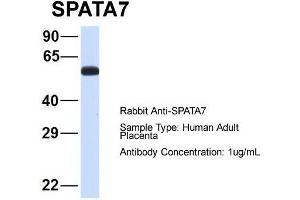 Host: Rabbit  Target Name: SPATA7  Sample Tissue: Human Adult Placenta  Antibody Dilution: 1. (SPATA7 anticorps  (Middle Region))