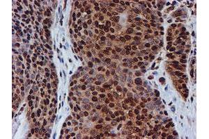 Image no. 11 for anti-Fragile X Mental Retardation 1 (FMR1) antibody (ABIN1498287)