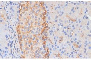 Immunohistochemistry of paraffin-embedded Rat pancreas using DLL1 Polyclonal Antibody at dilution of 1:100 (40x lens). (DLL1 anticorps)
