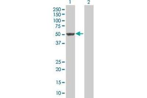 Lane 1: SNIP1 transfected lysate ( 43. (SNIP1 293T Cell Transient Overexpression Lysate(Denatured))