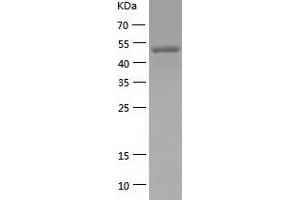 EED Protein (AA 1-441) (His tag)