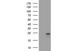 Image no. 1 for anti-Visinin-Like 1 (VSNL1) (AA 2-191) antibody (ABIN1491129) (VSNL1 anticorps  (AA 2-191))