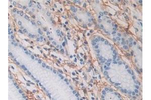 Detection of POSTN in Human Stomach Tissue using Polyclonal Antibody to Periostin (POSTN)