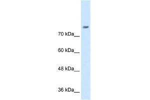 WB Suggested Anti-NRCAM Antibody Titration:  0. (NrCAM anticorps  (N-Term))