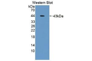 Detection of Recombinant TMOD3, Mouse using Polyclonal Antibody to Tropomodulin 3 (TMOD3)