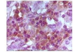 Immunohistochemical analysis of paraffin-embedded human lymphocyto tissue, showing cytoplasmic and nuclear localization using Foxp3 mouse mAb with DAB staining. (FOXP3 anticorps)