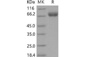 Western Blotting (WB) image for Opioid Binding Protein/cell Adhesion Molecule-Like (OPCML) (AA 1-541) (Active) protein (His tag) (ABIN7320094)